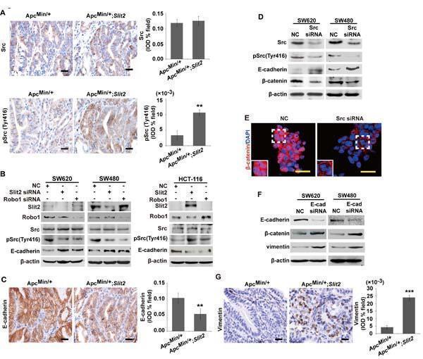 Slit2/Robo1 signaling activates the Src-mediated inhibition of E-cadherin