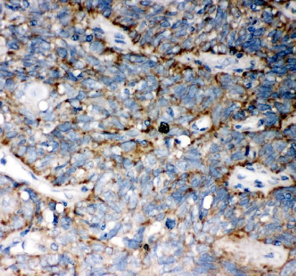  IHC analysis of Wnt5a using anti-Wnt5a antibody (PB9063)