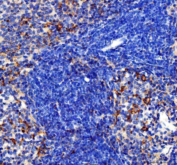  IHC analysis of CCL4 using anti-CCL4 antibody (PB9064)