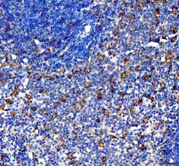  IHC analysis of CCL4 using anti-CCL4 antibody (PB9064)