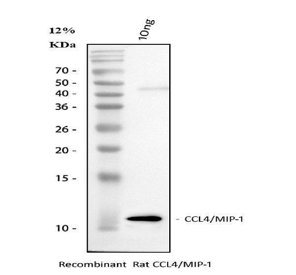  Western blot analysis of CCL4 using anti-CCL4 antibody (PB9064)