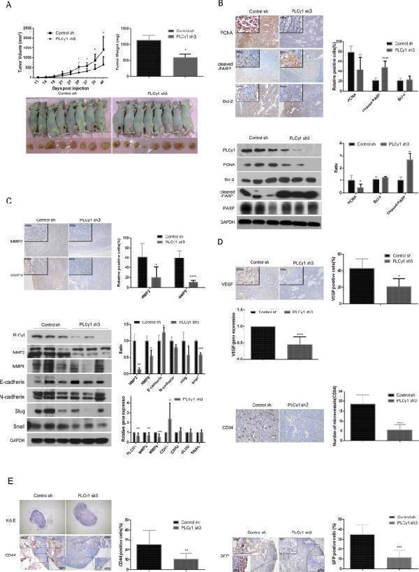pb9071 oncotarget 07 8043 g003 Depletion of PLCγ1 suppresses growth and metastasis of gastric adenocarcinoma in a nude mouse tumor xenograft model. ( A ) Volume and weight of tumor samples from nude mice. ( B ) The protein levels of PCNA, cleaved-PARP, PARP, and Bcl-2 in the tumor samples were detected by Immunohistochemistry (Magnificationx100, x400) and Western blotting analyses as described in Materials and Methods. ( C ) The levels of MMP2 and MMP9 in the tumor samples were detected by Immunohistochemistry analysis as described in Materials and Methods (Magnificationx100, x400). The protein and mRNA levels of MMP2, MMP9, E-cadherin(CDH1), N-cadherin(CDH2), snail(SNAIL), and slug(SLUG) in the tumor samples were detected by Western Blotting and Real-time PCR analyses as described in Materials and Methods. ( D ) The protein levels of VEGF and CD34 and the mRNA level of VEGF in tumor samples were detected by Immunohistochemistry and Real-time PCR analysis as described in Materials and Methods. The number of microvessels was accounted under OLYPUS x41 microscope (Magnification x100, x400). ( E ) The lymphoid follicles in inguinal lymph nodes of nude mice were observed under OLYPUS x41microscope, and the protein levels of CD44 and GFP in inguinal lymph nodes of nude mice was detected by Immunohistochemistry analysis as described in Materials and Methods (Magnificationx40, x400). Data are reported as means ± S.D. of three independent experiments (* P < 0.05, ** P < 0.01, *** P < 0.001, **** P < 0.0001, vs respective control).Index in PubMed under a CC BY license. PMID: 26811493