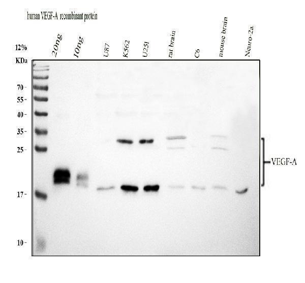 pb9071 vegfa primary antibodies wb testing 1 Western blot analysis of VEGF/VEGFA using anti-VEGF/VEGFA antibody (PB9071). 
Electrophoresis was performed on a 12% SDS-PAGE gel at 80V (Stacking gel) / 120V (Resolving gel) for 2 hours. The sample well of each lane was loaded with 30 ug of sample under reducing conditions. 
Lane 1: recombinant human VEGF/VEGFA protein 20ng, 
Lane 2: recombinant human VEGF/VEGFA protein 10ng, 
Lane 3: human U87 whole cell lysates, 
Lane 4: human K562 whole cell lysates, 
Lane 5: rat brain tissue lysates, 
Lane 6: rat C6 whole cell lysates, 
Lane 7: mouse brain tissue lysates, 
Lane 8: mouse Neuro-2a whole cell lysates. 
After electrophoresis, proteins were transferred to a nitrocellulose membrane at 150 mA for 50-90 minutes. Blocked the membrane with 5% non-fat milk/TBS for 1.5 hour at RT. The membrane was incubated with rabbit anti-VEGF/VEGFA antigen affinity purified polyclonal antibody (PB9071) at 0.5 μg/mL overnight at 4°C, then washed with TBS-0.1%Tween 3 times with 5 minutes each and probed with a goat anti-rabbit IgG-HRP secondary antibody (Catalog # BA1054) at a dilution of 1:5000 for 1.5 hour at RT. The signal is developed using an ECL Plus Western Blotting Substrate (Catalog # AR1196-200) with Tanon 5200 system. A specific band was detected for VEGF/VEGFA at approximately 18, 27 kDa. The expected band size for VEGF/VEGFA is at 27 kDa.