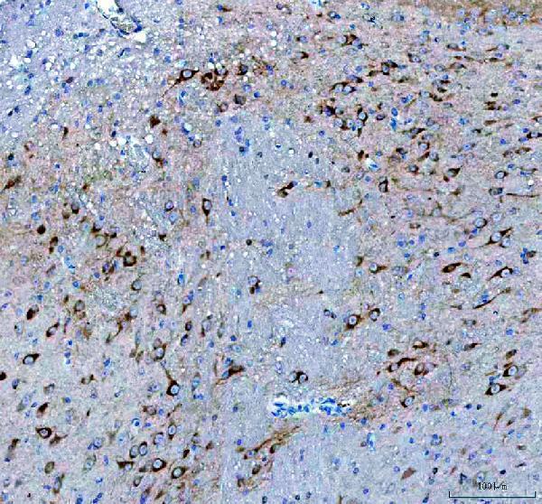 pb9075 bdnf primary antibodies ihc testing 2