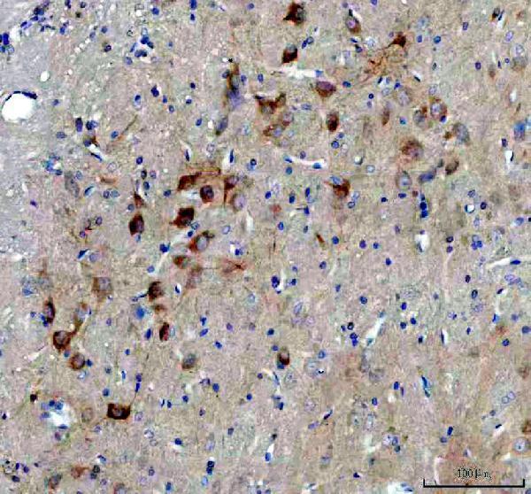pb9075 bdnf primary antibodies ihc testing 3