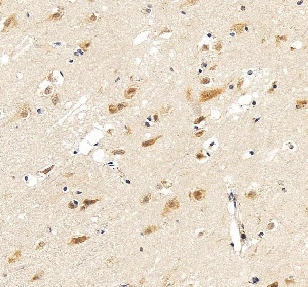pb9075 bdnf primary antibodies ihc testing 4