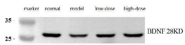 pb9075 bdnf primary antibodies wb review 1