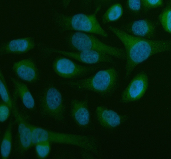 pb9076 beclin 1 primary antibodies if testing 2_1
