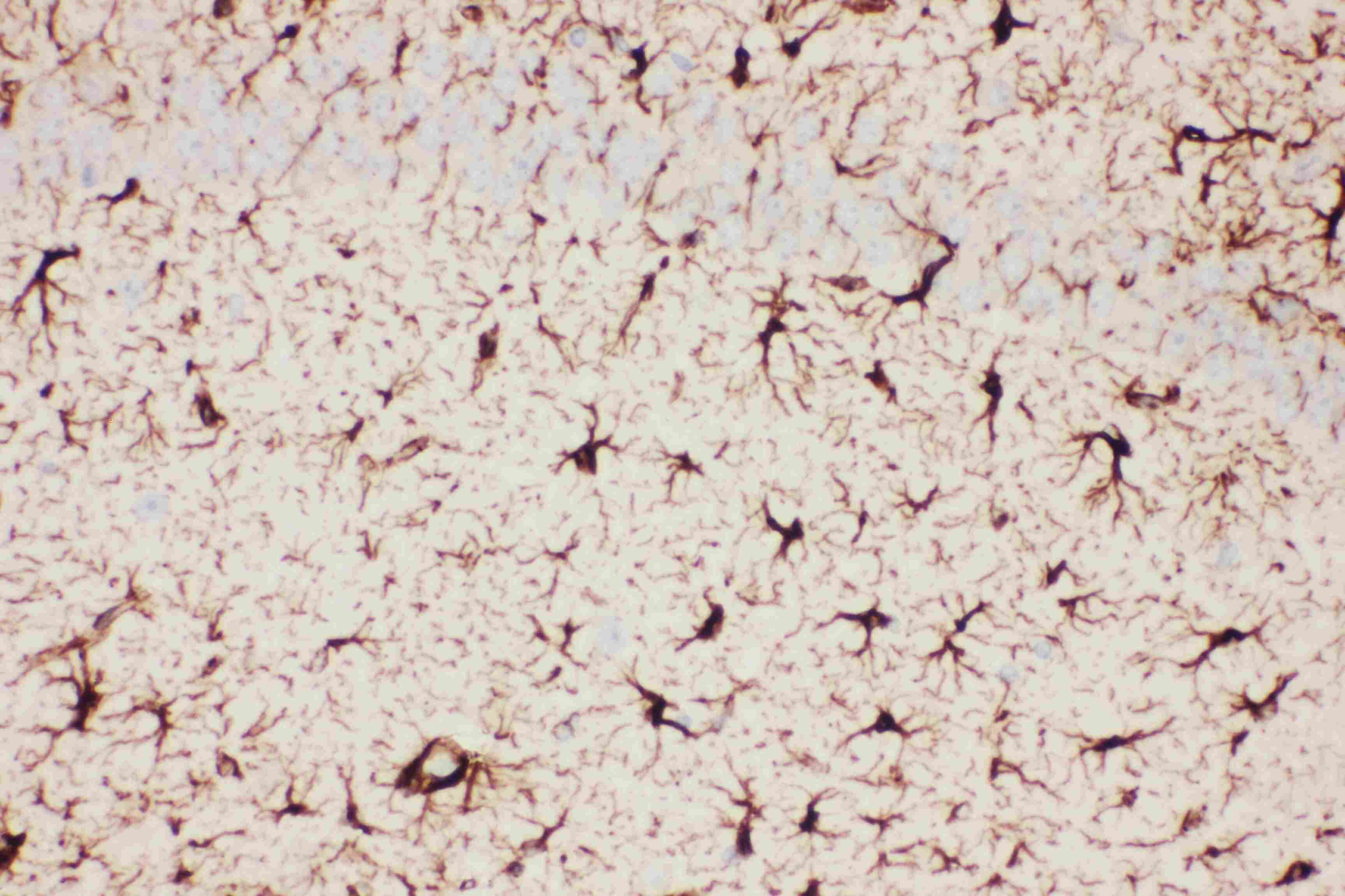 Anti-GFAP Picoband™ Antibody PB9082