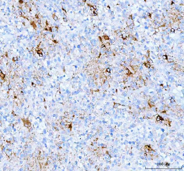 pb9082 gfap primary antibodies ihc testing 2_1