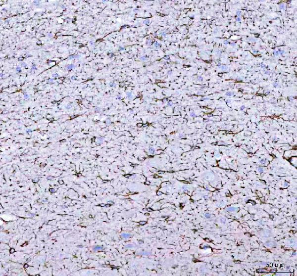 pb9082 gfap primary antibodies ihc testing 6_1