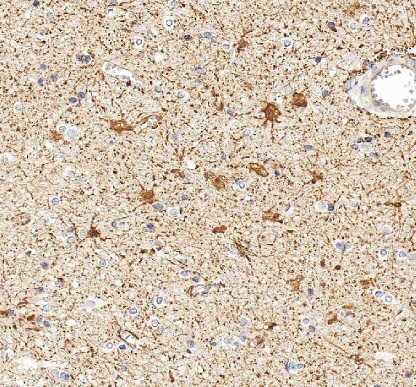 pb9082 gfap primary antibodies ihc testing 7