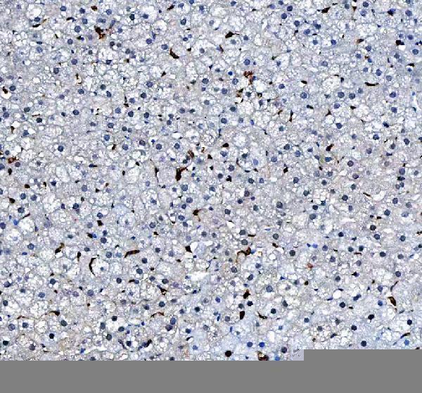 pb9085 hmox1 primary antibodies ihc testing 2_1