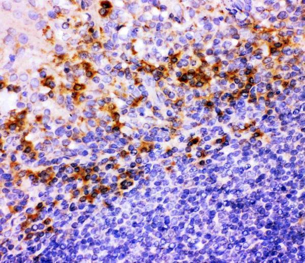  IHC analysis of ITGB1 using anti-ITGB1 antibody (PB9086)