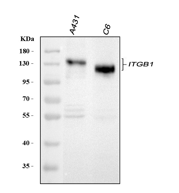  Western blot analysis of ITGB1 using anti-ITGB1 antibody (PB9086)