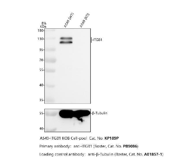 Western blot analysis of Integrin Beta 1/ITGB1 using anti-Integrin Beta 1/ITGB1 antibody (PB9086)