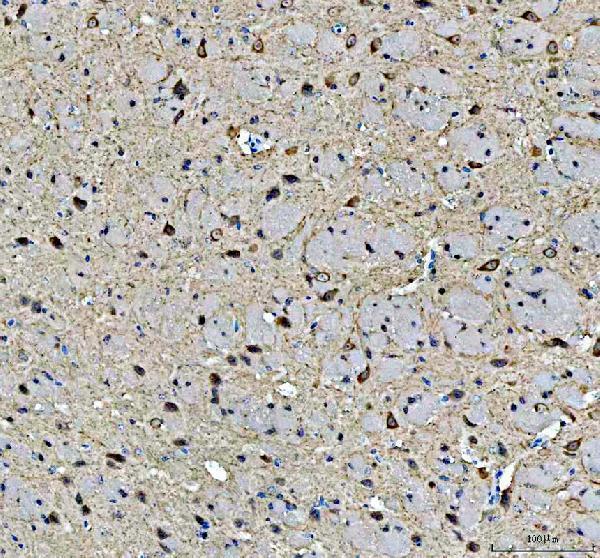pb9089 hsp90aa1 primary antibodies ihc testing 1