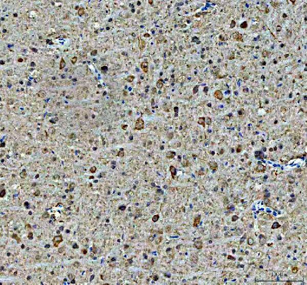 pb9089 hsp90aa1 primary antibodies ihc testing 2