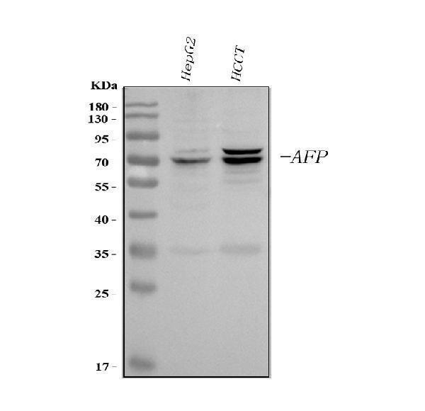  Western blot analysis of AFP using anti-AFP antibody (PB9090)