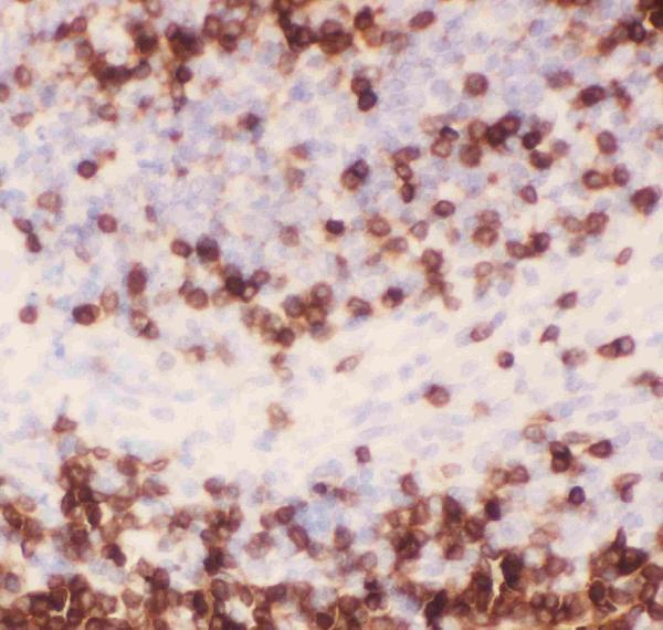 pb9093 4 ihc anti cd3 epsilon picoband antibody_1