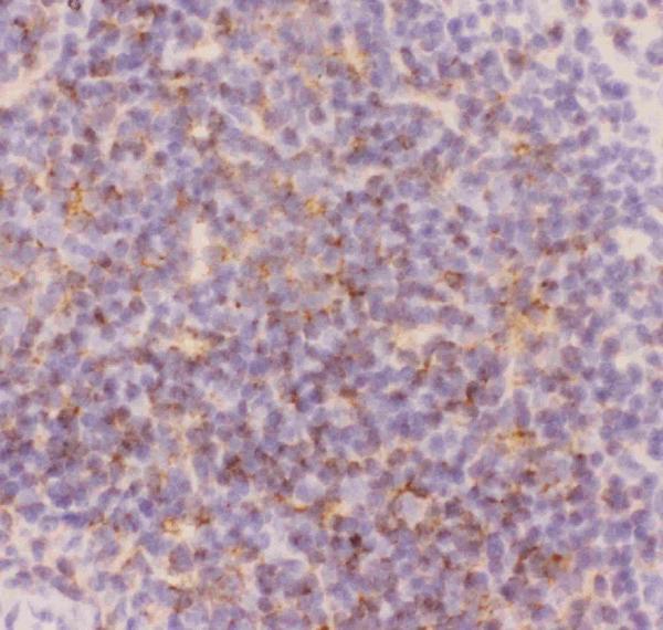 Figure 6. IHC analysis of CD3 Epsilon using anti-CD3 Epsilon antibody (PB9093). CD3 Epsilon was detected in frozen section of mouse spleen tissues. The tissue section was blocked with 10% goat serum. The tissue section was then incubated with 1microg/ml rabbit anti-CD3 Epsilon Antibody (PB9093) overnight at 4°C. Biotinylated goat anti-rabbit IgG was used as secondary antibody and incubated for 30 minutes at 37°C. The tissue section was developed using Strepavidin-Biotin-Complex (SABC)(Catalog # SA1022) with DAB as the chromogen. Figure 6. IHC analysis of CD3 Epsilon using anti-CD3 Epsilon antibody (PB9093). CD3 Epsilon was detected in frozen section of mouse spleen tissues. The tissue section was blocked with 10% goat serum. The tissue section was then incubated with 1microg/ml rabbit anti-CD3 Epsilon Antibody (PB9093) overnight at 4°C. Biotinylated goat anti-rabbit IgG was used as secondary antibody and incubated for 30 minutes at 37°C. The tissue section was developed using Strepavidin-Biotin-Complex (SABC)(Catalog # SA1022) with DAB as the chromogen.