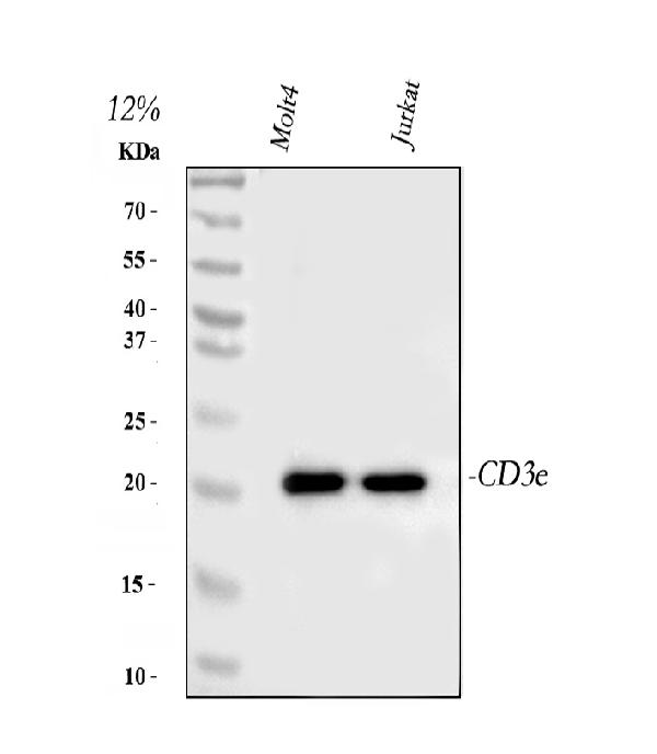 Figure 1. Western blot analysis of CD3E using anti-CD3E antibody (PB9093). Electrophoresis was performed on a 5-20% SDS-PAGE gel at 70V (Stacking gel) / 90V (Resolving gel) for 2-3 hours. The sample well of each lane was loaded with 30 ug of sample under reducing conditions. Lane 1: human MOLT-4 whole cell lysates, Lane 2: human Jurkat whole cell lysates. After electrophoresis, proteins were transferred to a nitrocellulose membrane at 150 mA for 50-90 minutes. Blocked the membrane with 5% non-fat milk/TBS for 1.5 hour at RT. The membrane was incubated with rabbit anti-CD3E antigen affinity purified polyclonal antibody (Catalog # PB9093) at 0.5 microg/mL overnight at 4°C, then washed with TBS-0.1%Tween 3 times with 5 minutes each and probed with a goat anti-rabbit IgG-HRP secondary antibody at a dilution of 1:5000 for 1.5 hour at RT. The signal is developed using an Enhanced Chemiluminescent detection (ECL) kit (Catalog # EK1002) with Tanon 5200 system. A specific band was detected for CD3E at approximately 23 kDa. The expected band size for CD3E is at 23 kDa.
