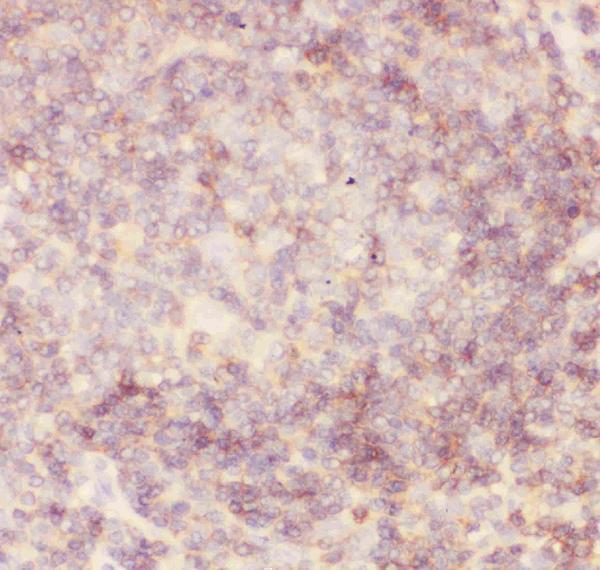 pb9096 2 ihc anti cd45 picoband antibody