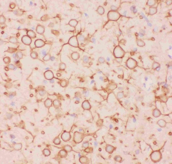 pb9111 3 ihc anti kv2 1 picoband antibody_1
