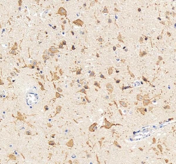 pb9111 kcnb1 primary antibodies ihc testing 7
