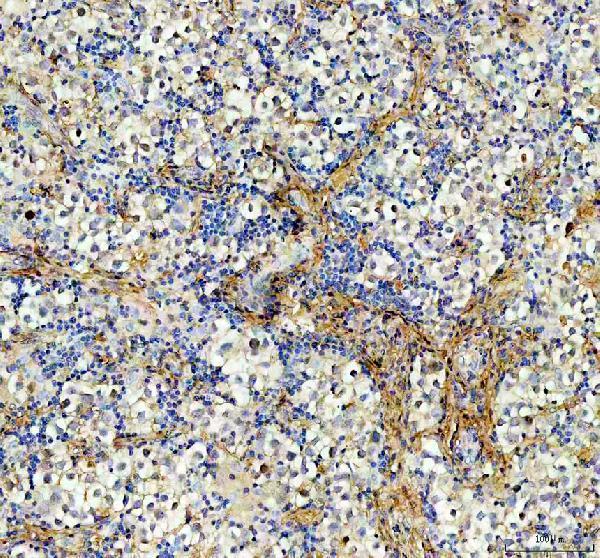 pb9123 aamp primary antibodies ihc testing 2