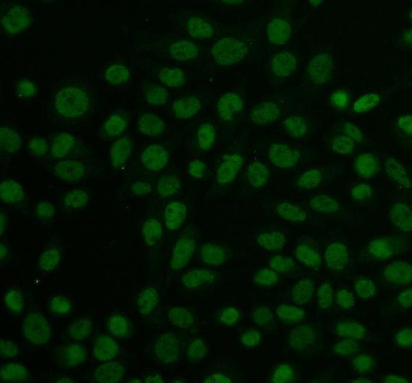 pb9130 atf1 primary antibodies if testing 1