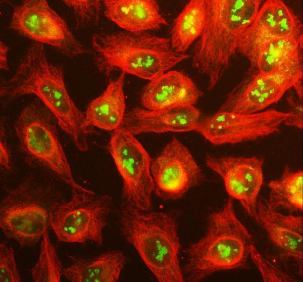 pb9130 atf1 primary antibodies if testing 1_1