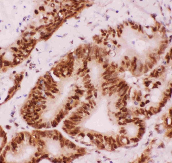 pb9131 3 ihc anti atf2 picoband antibody