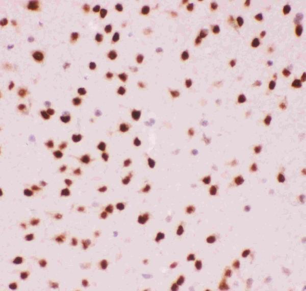 pb9131 4 ihc anti atf2 picoband antibody