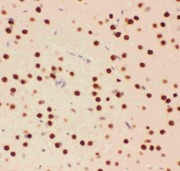 pb9131 5 ihc anti atf2 picoband antibody