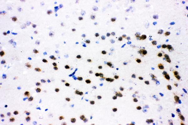pb9131 7 ihc anti atf2 picoband antibody