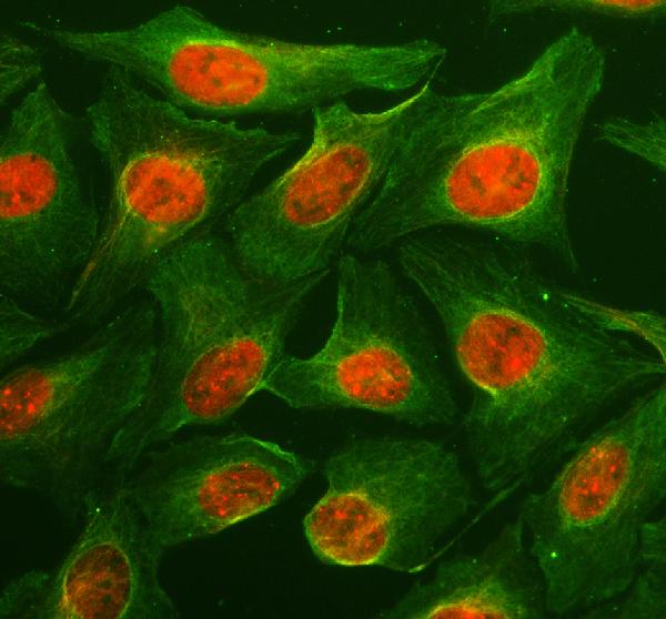 IF analysis of Bmi1 using anti-Bmi1 antibody (PB9133) and anti-Alpha Tubulin antibody (M03989-3)