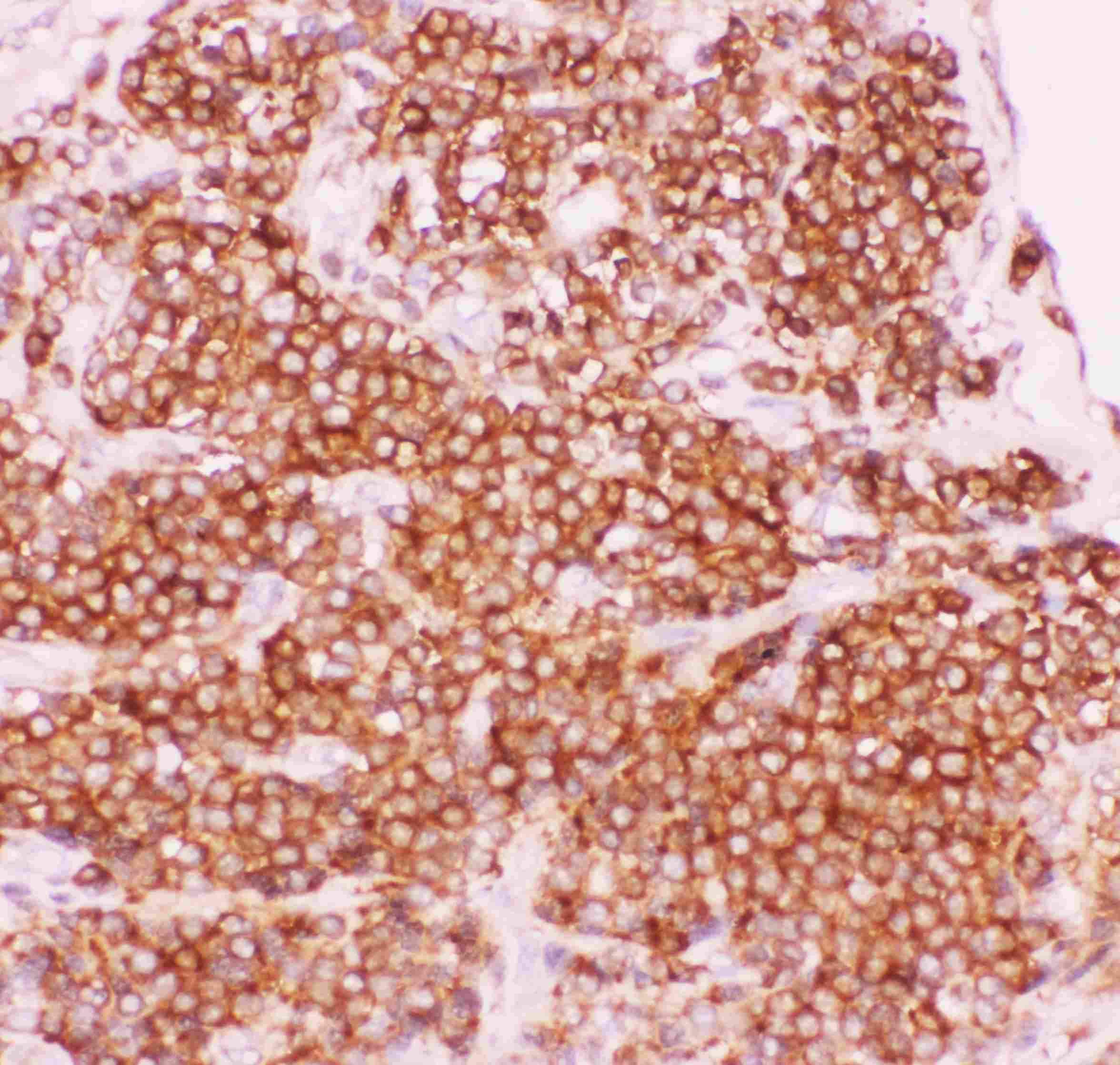 Anti-NFkB p105/P50 Picoband™ Antibody PB9149
