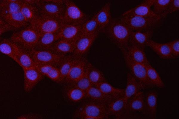 pb9149 nfkb1 primary antibodies if testing 2