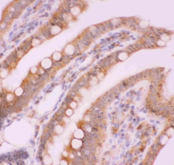 Figure 2. IHC analysis of NFkB/NFKB2 p100/p52 using anti-NFkB/NFKB2 p100/p52 antibody (PB9150). NFkB/NFKB2 p100/p52 was detected in a paraffin-embedded section of rat intestine tissue. Heat mediated antigen retrieval was performed in EDTA buffer (pH 8.0, epitope retrieval solution). The tissue section was blocked with 10% goat serum. The tissue section was then incubated with 1 microg/ml rabbit anti-NFkB/NFKB2 p100/p52 Antibody (PB9150) overnight at 4°C. Biotinylated goat anti-rabbit IgG was used as secondary antibody and incubated for 30 minutes at 37°C. The tissue section was developed using Strepavidin-Biotin-Complex (SABC) (Catalog # SA1022) with DAB as the chromogen.