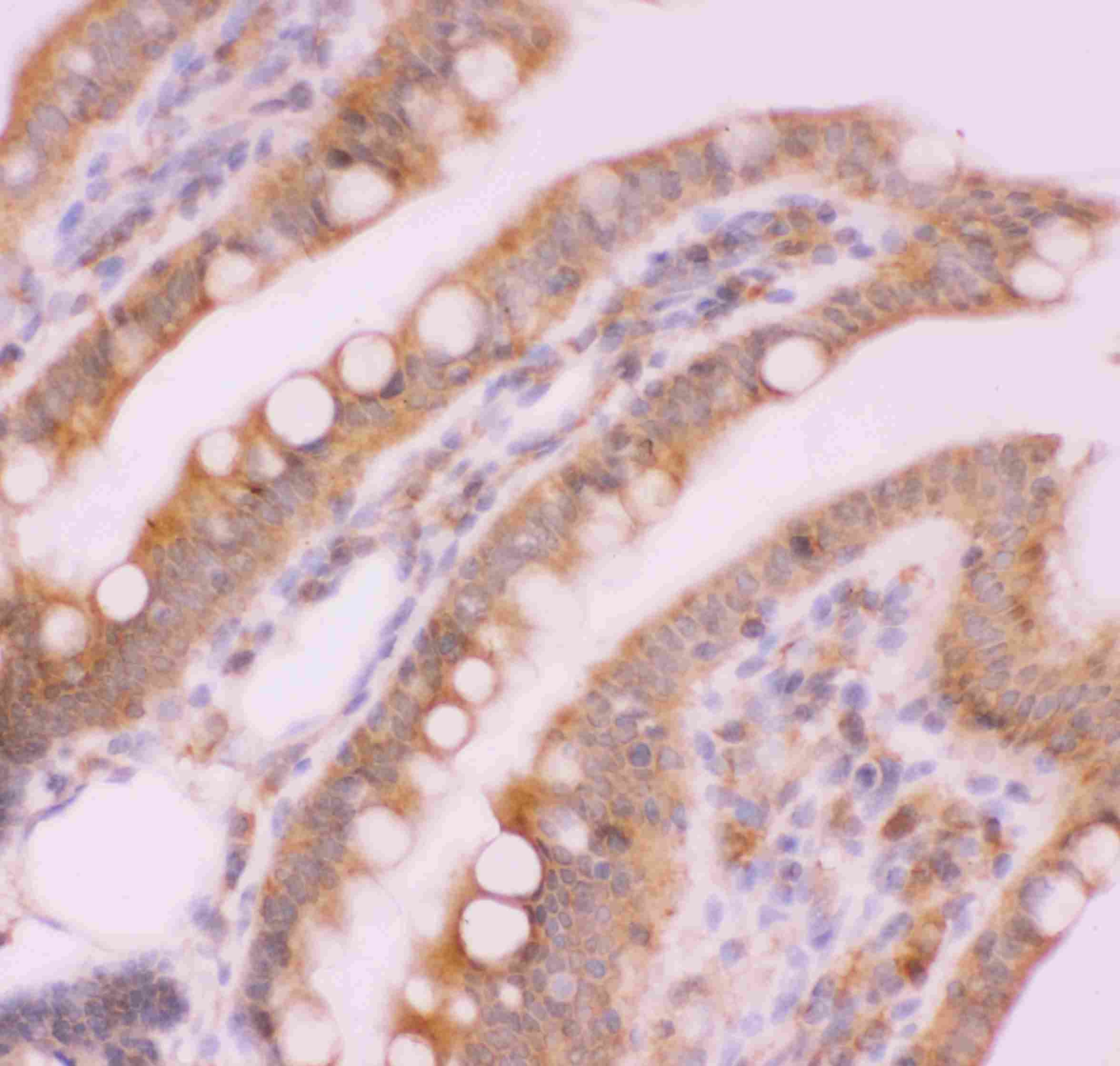 Anti-NFkB p100/p52 Picoband™ Antibody PB9150