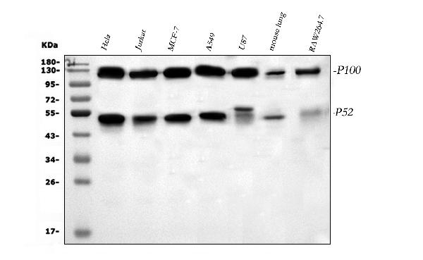 Figure 1. Western blot analysis of NFkB/NFKB2 p100/p52 using anti-NFkB/NFKB2 p100/p52 antibody (PB9150). Electrophoresis was performed on a 5-20% SDS-PAGE gel at 70V (Stacking gel) / 90V (Resolving gel) for 2-3 hours. The sample well of each lane was loaded with 30 ug of sample under reducing conditions. Lane 1: human Hela whole cell lysates, Lane 2: human Jurkat whole cell lysates, Lane 3: human MCF-7 whole cell lysates, Lane 4: human A549 whole cell lysates, Lane 5: human U87 whole cell lysates, Lane 6: mouse lung tissue lysates, Lane 7: mouse RAW264.7 whole cell lysates. After electrophoresis, proteins were transferred to a nitrocellulose membrane at 150 mA for 50-90 minutes. Blocked the membrane with 5% non-fat milk/TBS for 1.5 hour at RT. The membrane was incubated with rabbit anti-NFkB/NFKB2 p100/p52 antigen affinity purified polyclonal antibody (Catalog # PB9150) at 0.5 microg/mL overnight at 4°C, then washed with TBS-0.1%Tween 3 times with 5 minutes each and probed with a goat anti-rabbit IgG-HRP secondary antibody at a dilution of 1:5000 for 1.5 hour at RT. The signal is developed using an Enhanced Chemiluminescent detection (ECL) kit (Catalog # EK1002) with Tanon 5200 system. A specific band was detected for NFkB/NFKB2 p100/p52 at approximately 52 kDa (active form), 120kDa (precursor). The expected band size for NFkB/NFKB2 p100/p52 is at 97 kDa.
