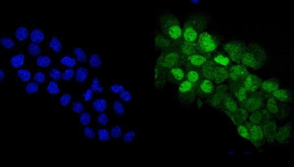 pb9152 p63 primary antibodies if testing 3_1