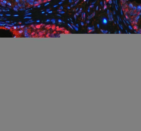 pb9152 p63 primary antibodies if testing 4