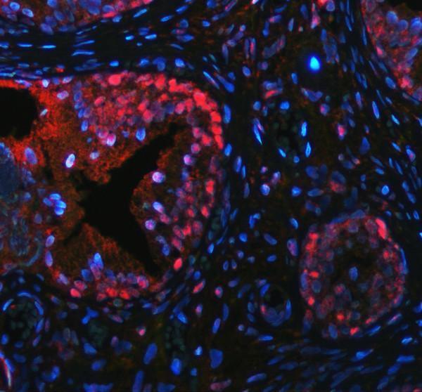 pb9152 p63 primary antibodies if testing 4_1
