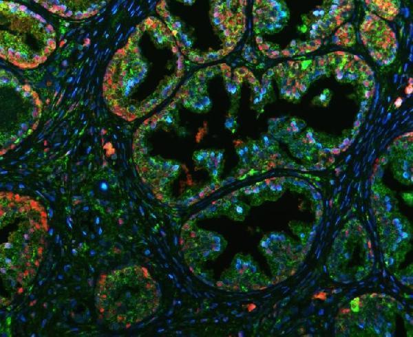 pb9152 pb9983 primary antibodies if testing 1