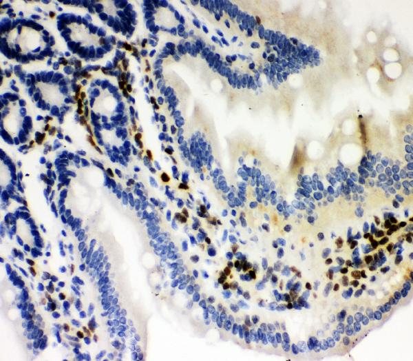 Figure 4. IHC analysis of RUNX3 using anti-RUNX3 antibody (PB9157). RUNX3 was detected in paraffin-embedded section of mouse intestine tissue. Heat mediated antigen retrieval was performed in citrate buffer (pH6, epitope retrieval solution) for 20 mins. The tissue section was blocked with 10% goat serum. The tissue section was then incubated with 1microg/ml rabbit anti-RUNX3 Antibody (PB9157) overnight at 4°C. Biotinylated goat anti-rabbit IgG was used as secondary antibody and incubated for 30 minutes at 37°C. The tissue section was developed using Strepavidin-Biotin-Complex (SABC)(Catalog # SA1022) with DAB as the chromogen.