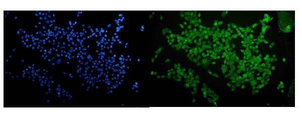 Figure 3. IF analysis of RUNX2 using anti-RUNX2 antibody (PB9158). RUNX2 was detected in immunocytochemical section of A431 cells. Enzyme antigen retrieval was performed using IHC enzyme antigen retrieval reagent (AR0022) for 15 mins. The cells were blocked with 10% goat serum. And then incubated with 5microg/mL rabbit anti-RUNX2 Antibody (PB9158) overnight at 4°C. DyLight®488 Conjugated Goat Anti-Rabbit IgG (BA1127) was used as secondary antibody at 1:100 dilution and incubated for 30 minutes at 37°C. The section was counterstained with DAPI. Visualize using a fluorescence microscope and filter sets appropriate for the label used. Figure 3. IF analysis of RUNX2 using anti-RUNX2 antibody (PB9158). RUNX2 was detected in immunocytochemical section of A431 cells. Enzyme antigen retrieval was performed using IHC enzyme antigen retrieval reagent (AR0022) for 15 mins. The cells were blocked with 10% goat serum. And then incubated with 5microg/mL rabbit anti-RUNX2 Antibody (PB9158) overnight at 4°C. DyLight®488 Conjugated Goat Anti-Rabbit IgG (BA1127) was used as secondary antibody at 1:100 dilution and incubated for 30 minutes at 37°C. The section was counterstained with DAPI. Visualize using a fluorescence microscope and filter sets appropriate for the label used.