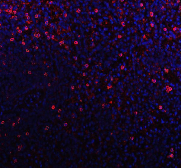pb9169 cd79b primary antibodies if testing 1