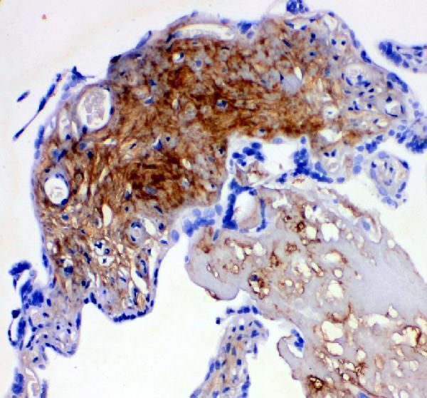 IHC analysis of Decorin using anti-Decorin antibody (PB9174)